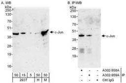 Detection of human and mouse c-Jun by western blot (h&m) and immunoprecipitation (h).