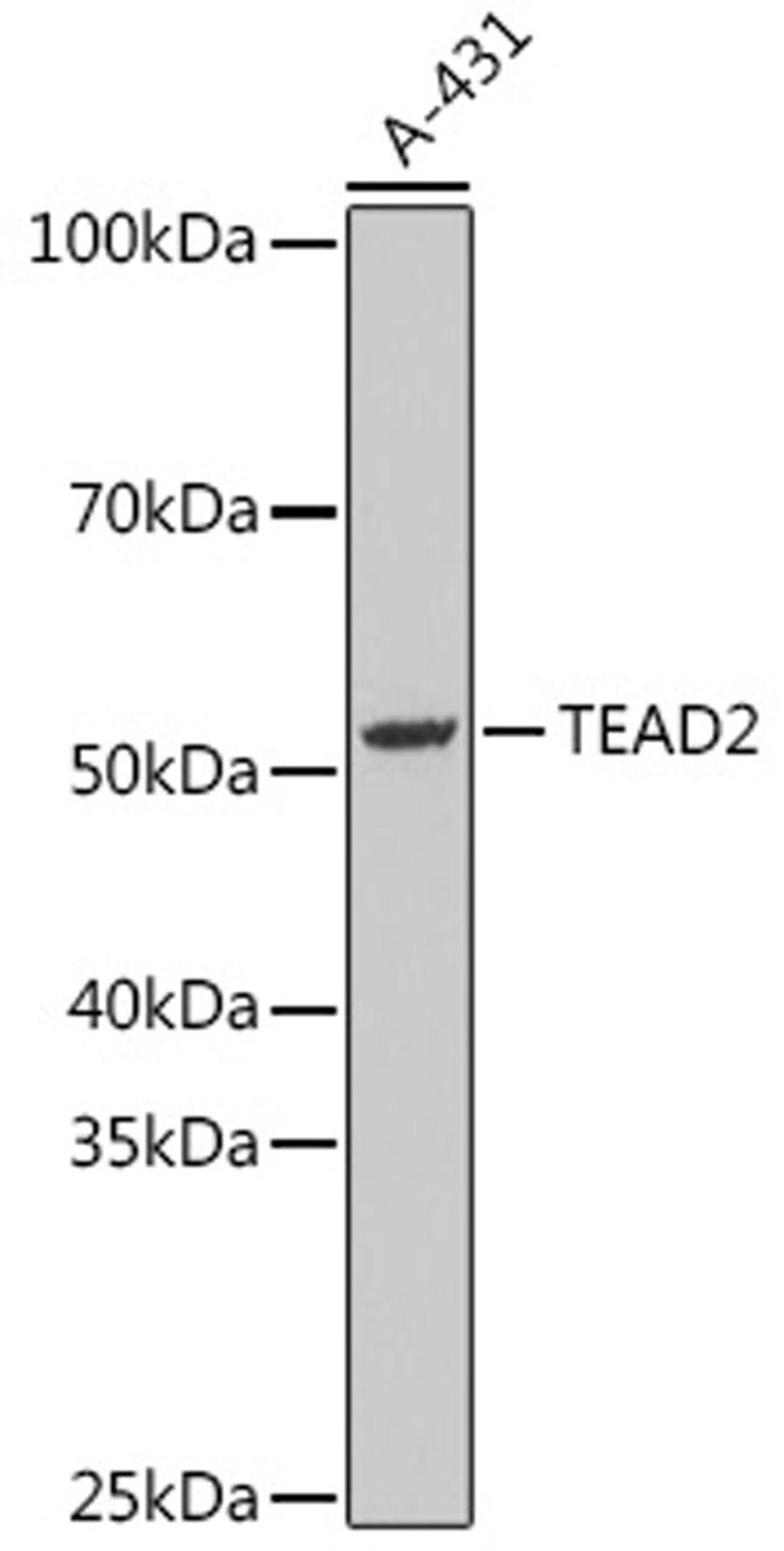 Western blot - HSPB7 antibody (A15594)