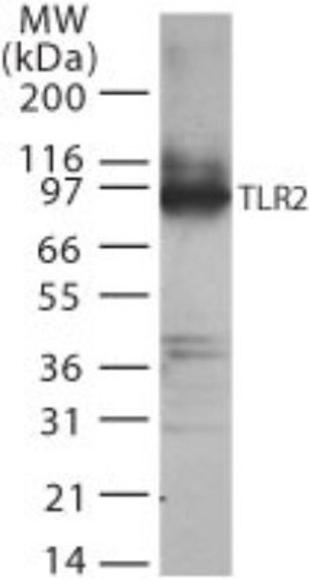 Western Blot: TLR2 Antibody [NB100-56720] - Analysis using the Azide Free version of NB100-56720. Detection of TLR2 in transfected cell lysate using this antibody.