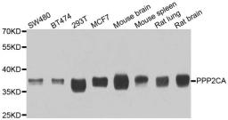 Western blot analysis of extracts of various cell lines using PPP2CA antibody