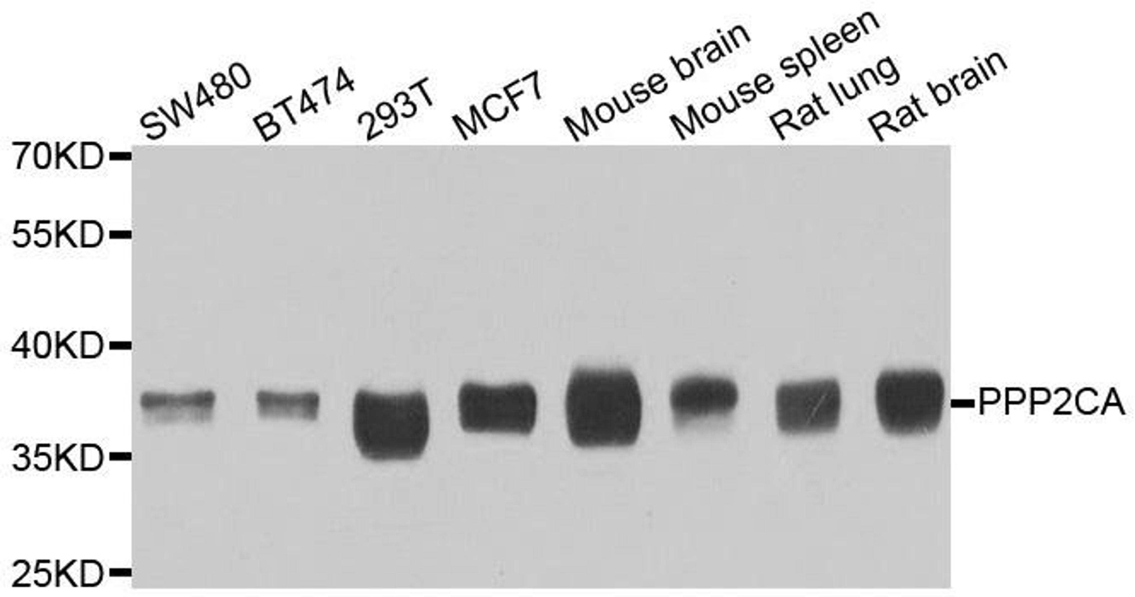 Western blot analysis of extracts of various cell lines using PPP2CA antibody