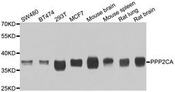 Western blot analysis of extracts of various cell lines using PPP2CA antibody