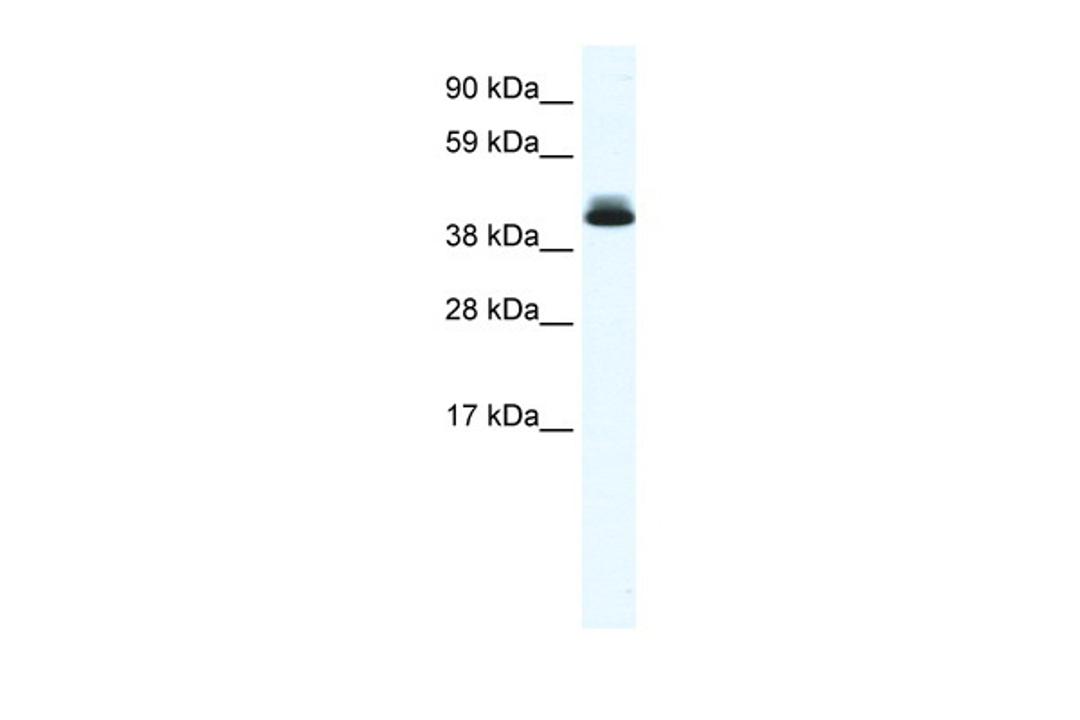 Antibody used in WB on Mouse SP2/0 at 0.3125 ug/ml.