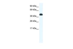 Antibody used in WB on Mouse SP2/0 at 0.3125 ug/ml.
