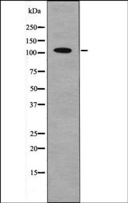 Western blot analysis of UV treated HeLa whole cell lysates using Androgen Receptor -Phospho-Tyr267- antibody