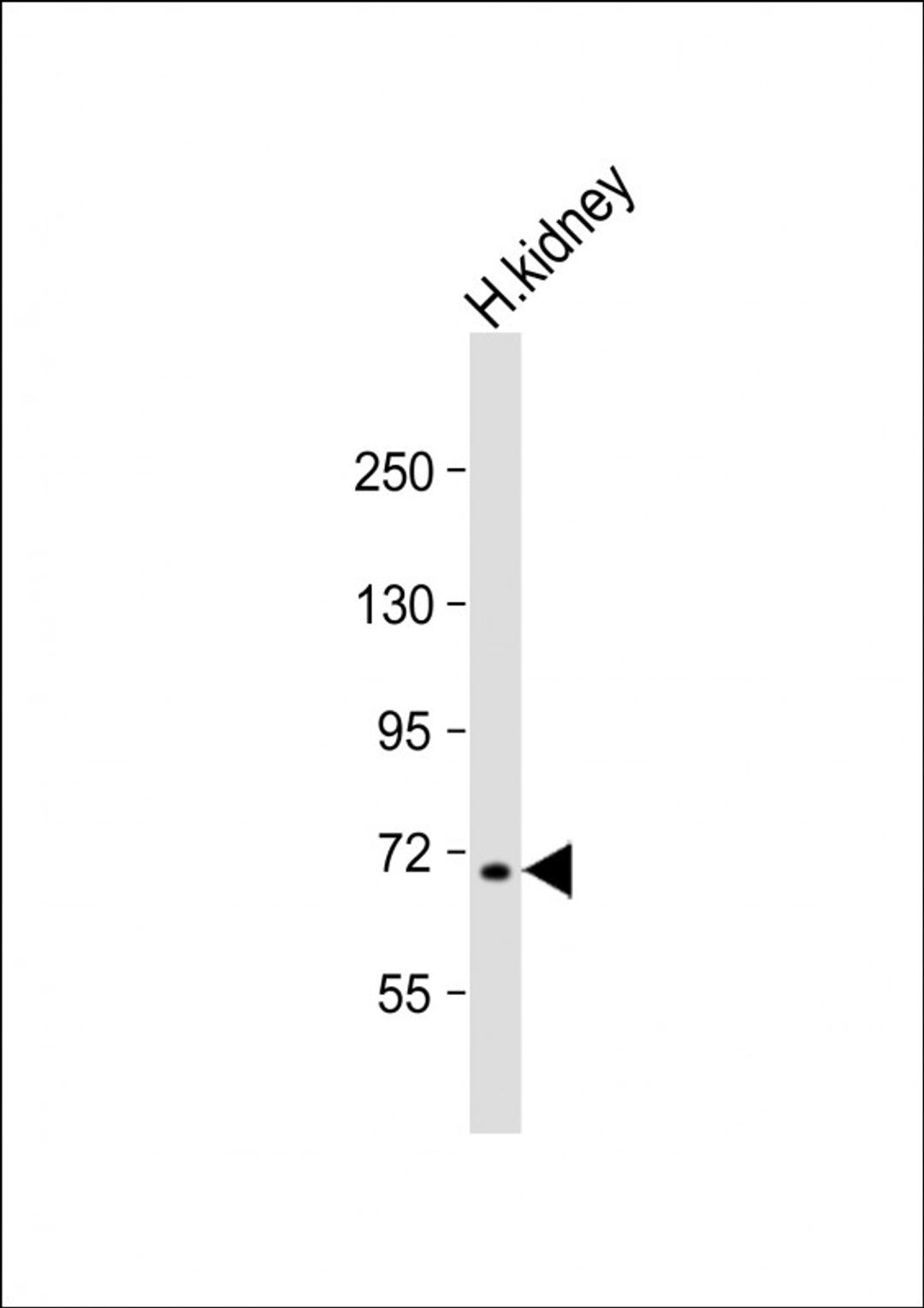 Western Blot at 1:1000 dilution + human kidney lysate Lysates/proteins at 20 ug per lane.