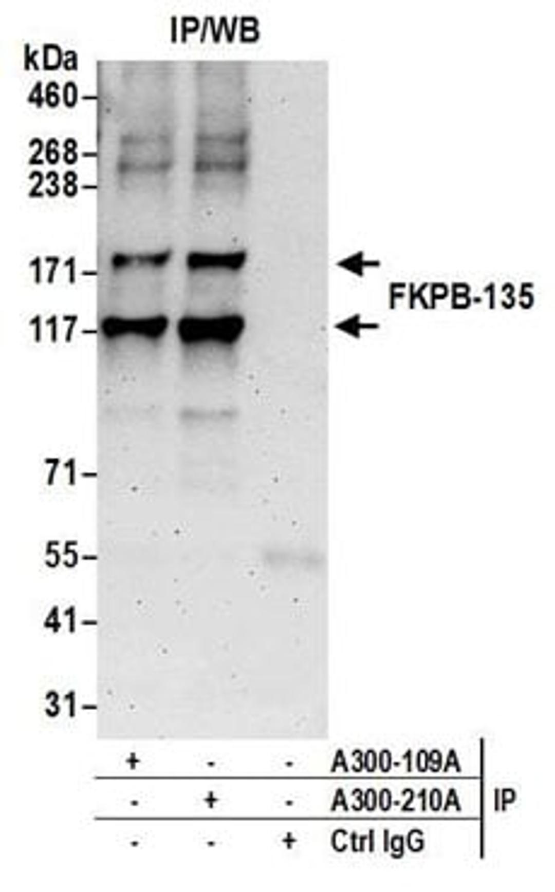 Detection of human FKPB-135 by western blot of immunoprecipitates.