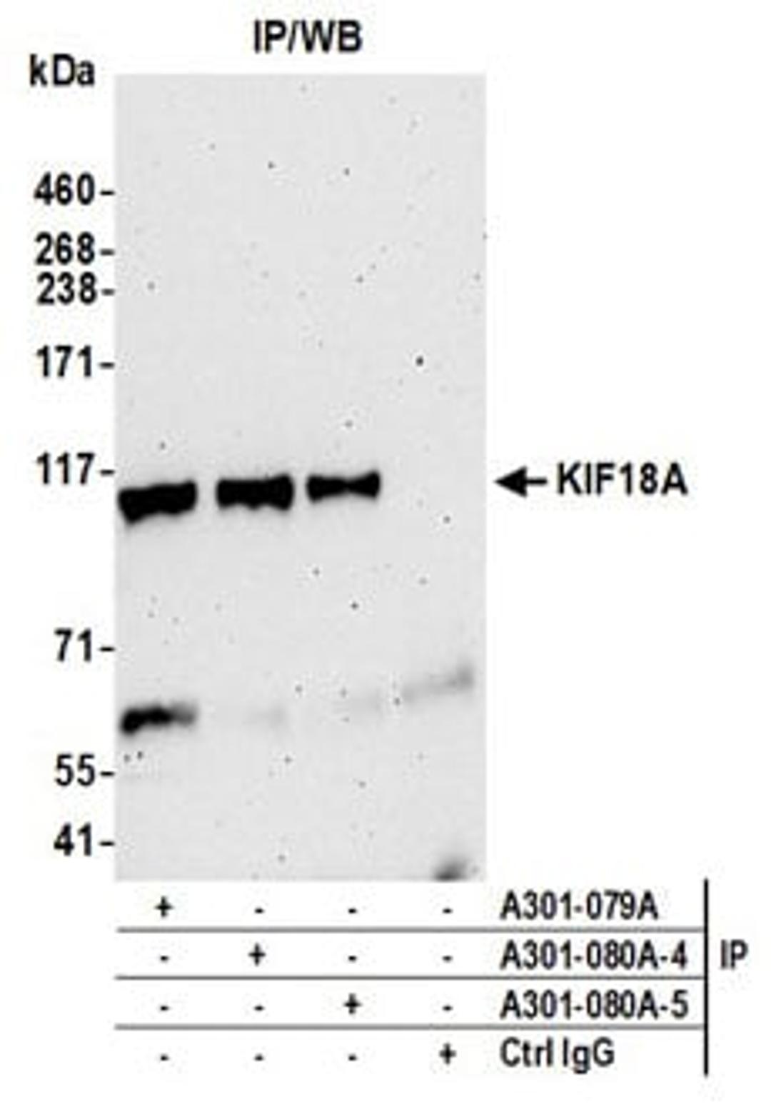 Detection of human KIF18A by western blot of immunoprecipitates.