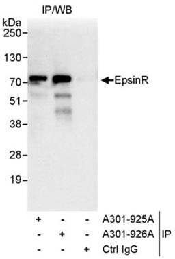 Detection of human EpsinR by western blot of immunoprecipitates.