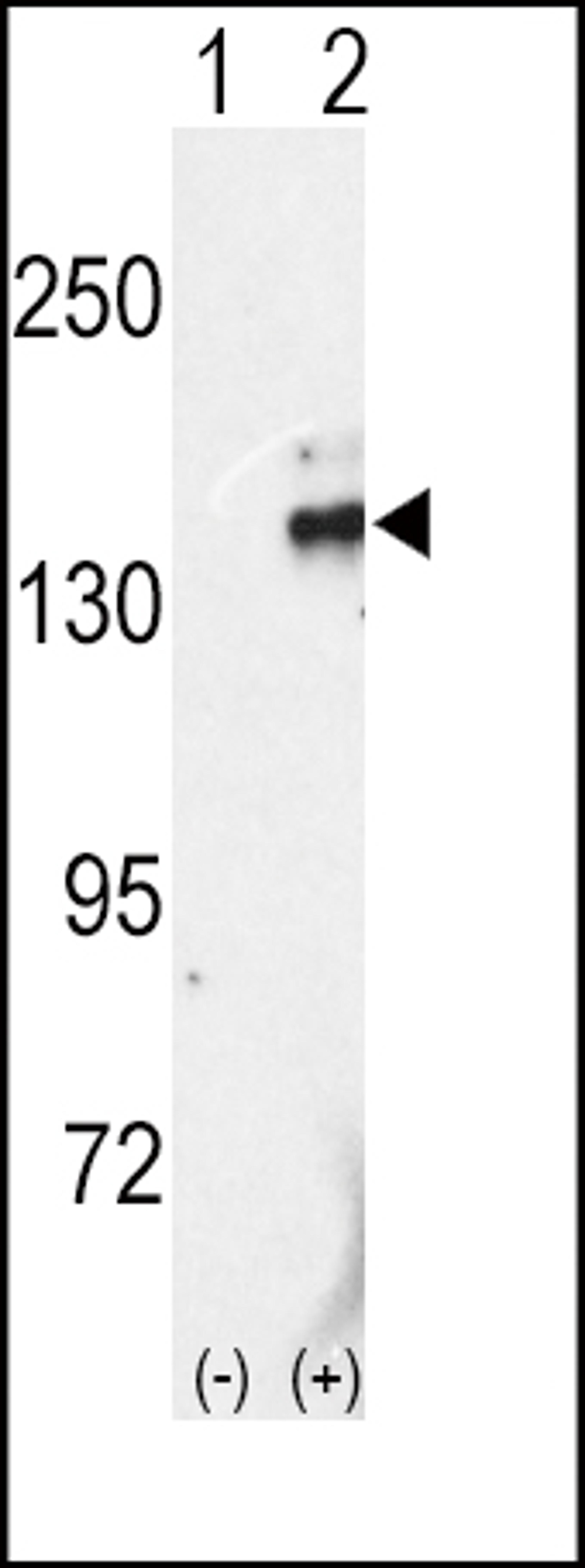 Western blot analysis of RET using rabbit polyclonal RET Antibody (C-term L1027) using 293 cell lysates (2 ug/lane) either nontransfected (Lane 1) or transiently transfected with the RET gene (Lane 2).