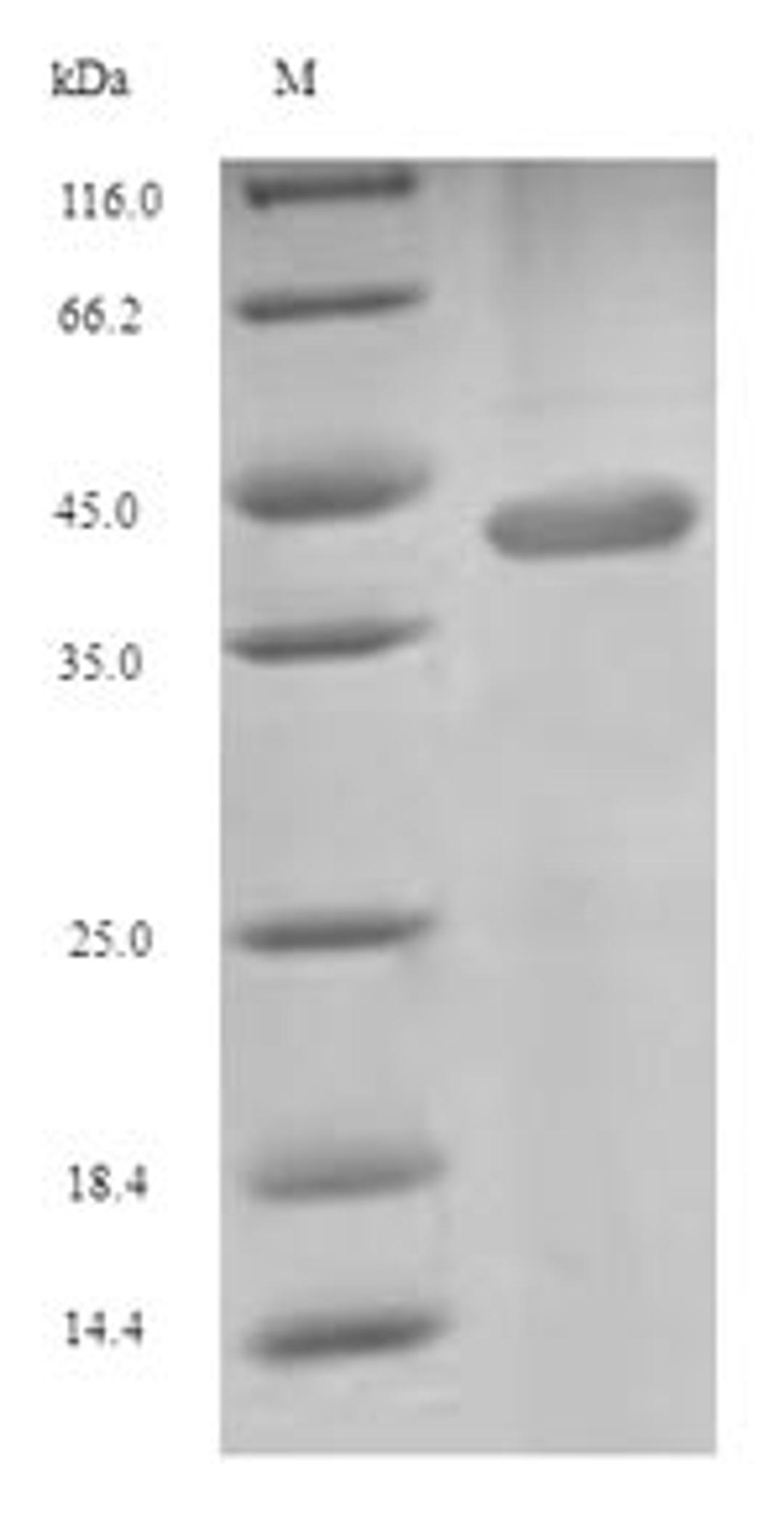 (Tris-Glycine gel) Discontinuous SDS-PAGE (reduced) with 5% enrichment gel and 15% separation gel.