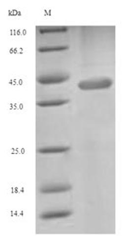 (Tris-Glycine gel) Discontinuous SDS-PAGE (reduced) with 5% enrichment gel and 15% separation gel.