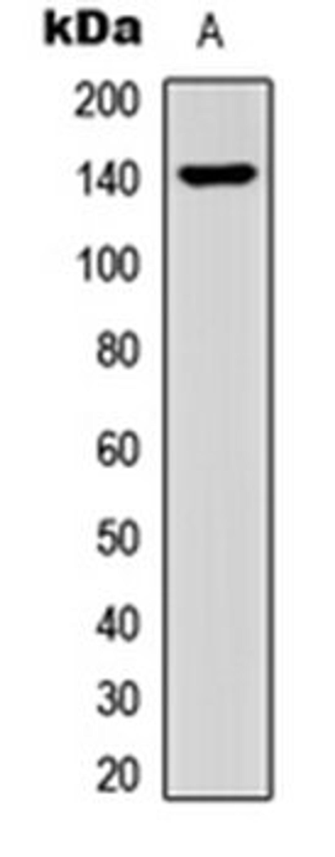 Western blot analysis of HEK293T (Lane 1) whole cell lysates using Collagen 15 alpha 1 antibody