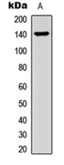 Western blot analysis of HEK293T (Lane 1) whole cell lysates using Collagen 15 alpha 1 antibody