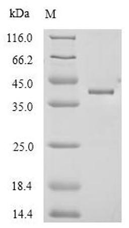 (Tris-Glycine gel) Discontinuous SDS-PAGE (reduced) with 5% enrichment gel and 15% separation gel.