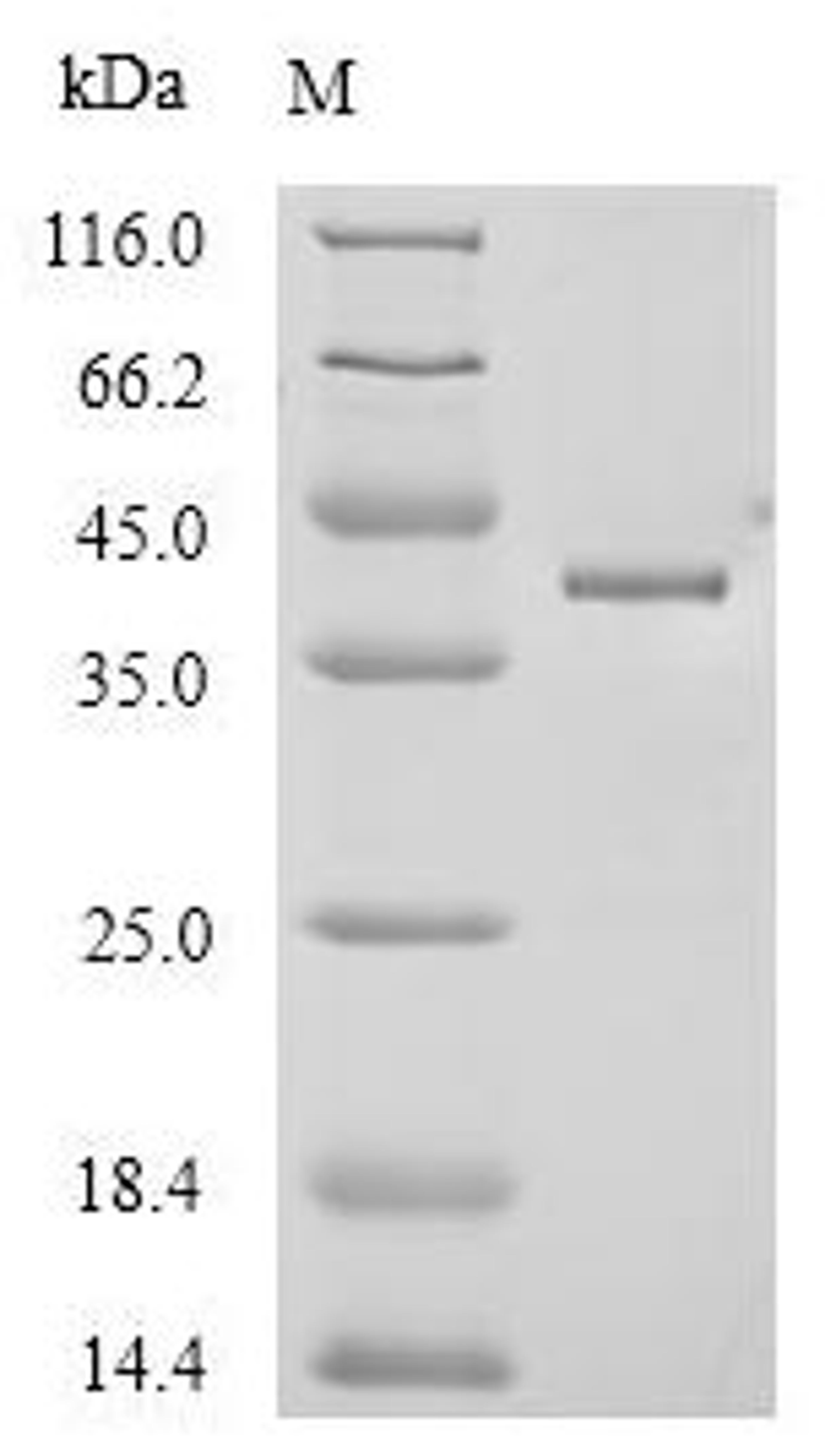 (Tris-Glycine gel) Discontinuous SDS-PAGE (reduced) with 5% enrichment gel and 15% separation gel.