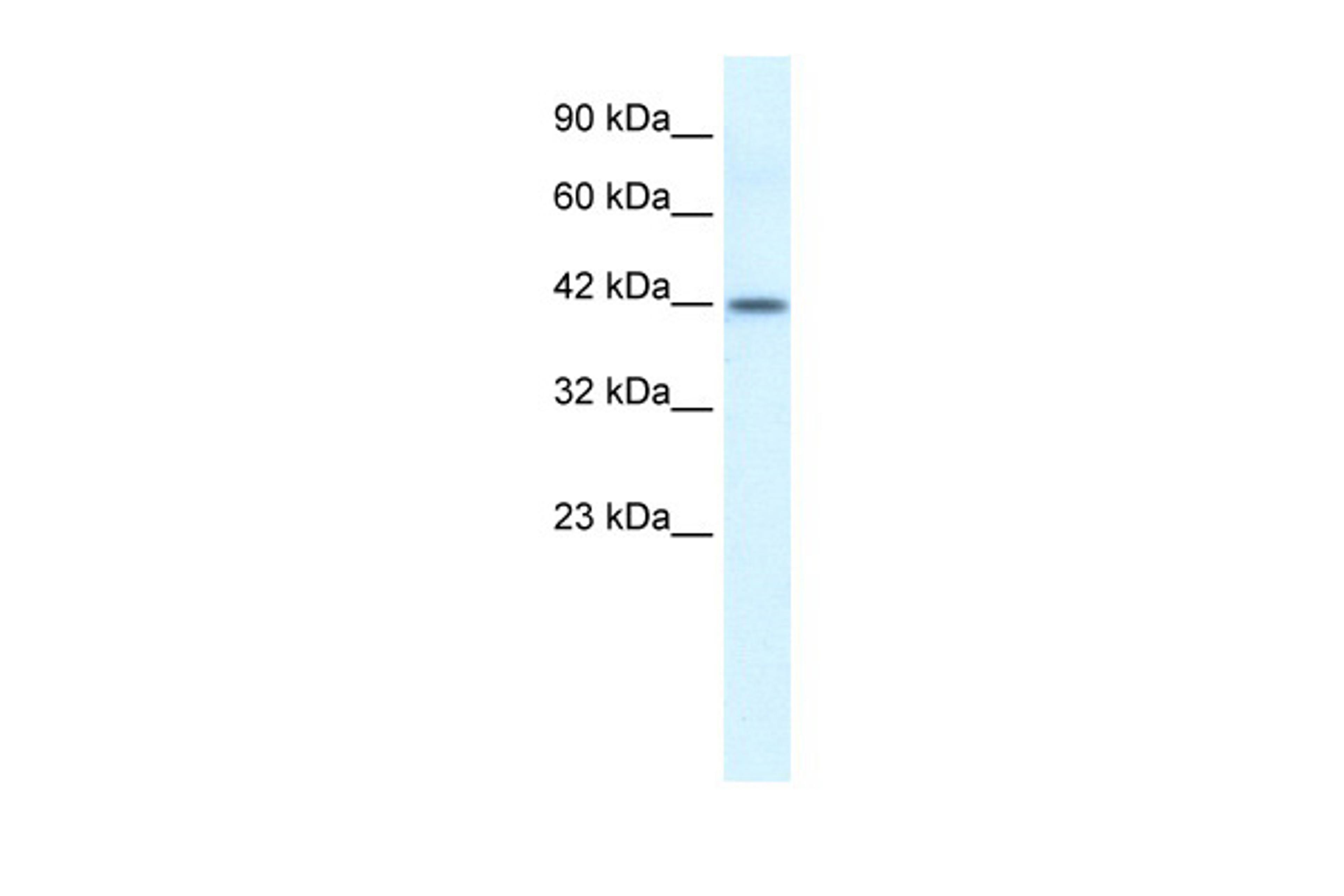 Antibody used in WB on Human HepG2 at 0.2-1 ug/ml.