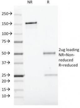 SDS-PAGE Analysis of Purified, BSA-Free CD19 Antibody (clone CVID3/429). Confirmation of Integrity and Purity of the Antibody.