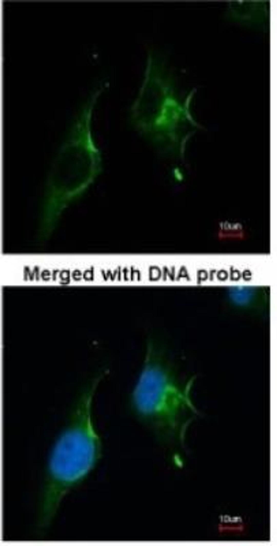 Immunocytochemistry/Immunofluorescence: NPR-1/Natriuretic Peptide Receptor A Antibody [NBP1-31333] - Paraformaldehyde-fixed HeLa, using antibody at 1:200 dilution.