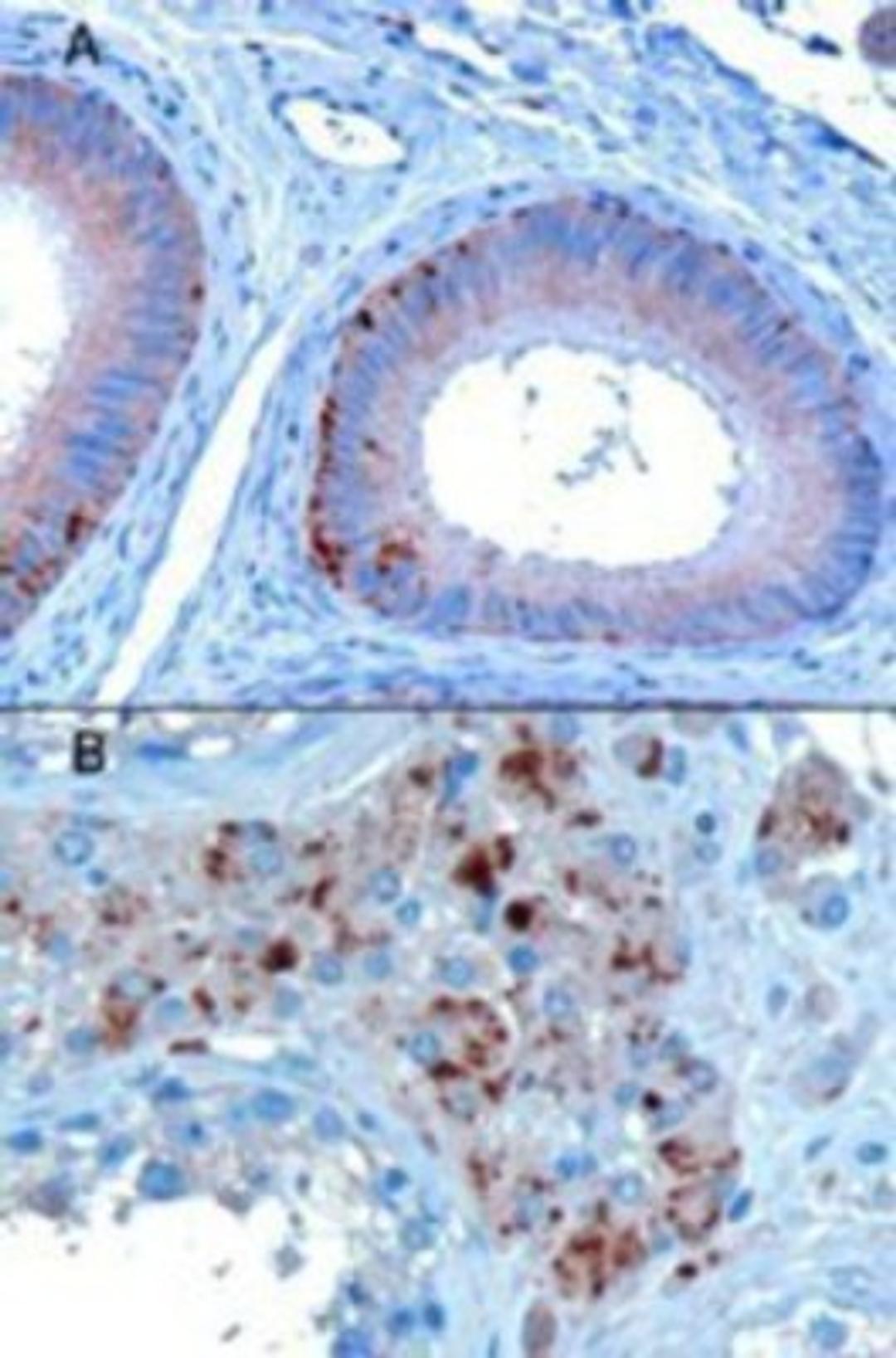 Immunohistochemistry-Paraffin: VPS35 Antibody [NB100-1397] - Staining of paraffin embedded Human Testis showing A) Epithelial cells of the epididymis and B) Some leydig cells. Microwaved antigen retrieval with A)Tris/EDTA buffer pH9 at 3ug/ml or B)Citrate buffer pH6 at 10ug/ml., HRP-staining.