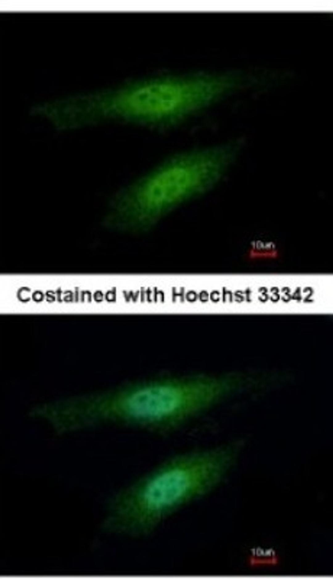 Immunocytochemistry/Immunofluorescence: MSH3 Antibody [NBP2-19417] - Analysis of paraformaldehyde-fixed HeLa, using antibody at 1:500 dilution.