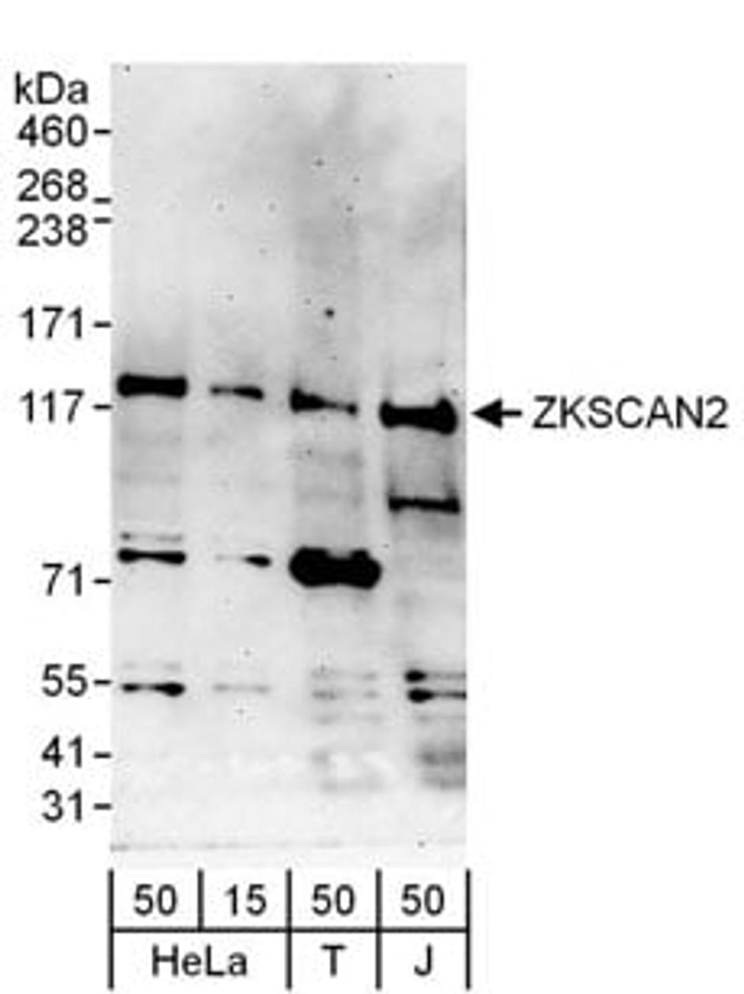 Detection of human ZKSCAN2 by western blot.