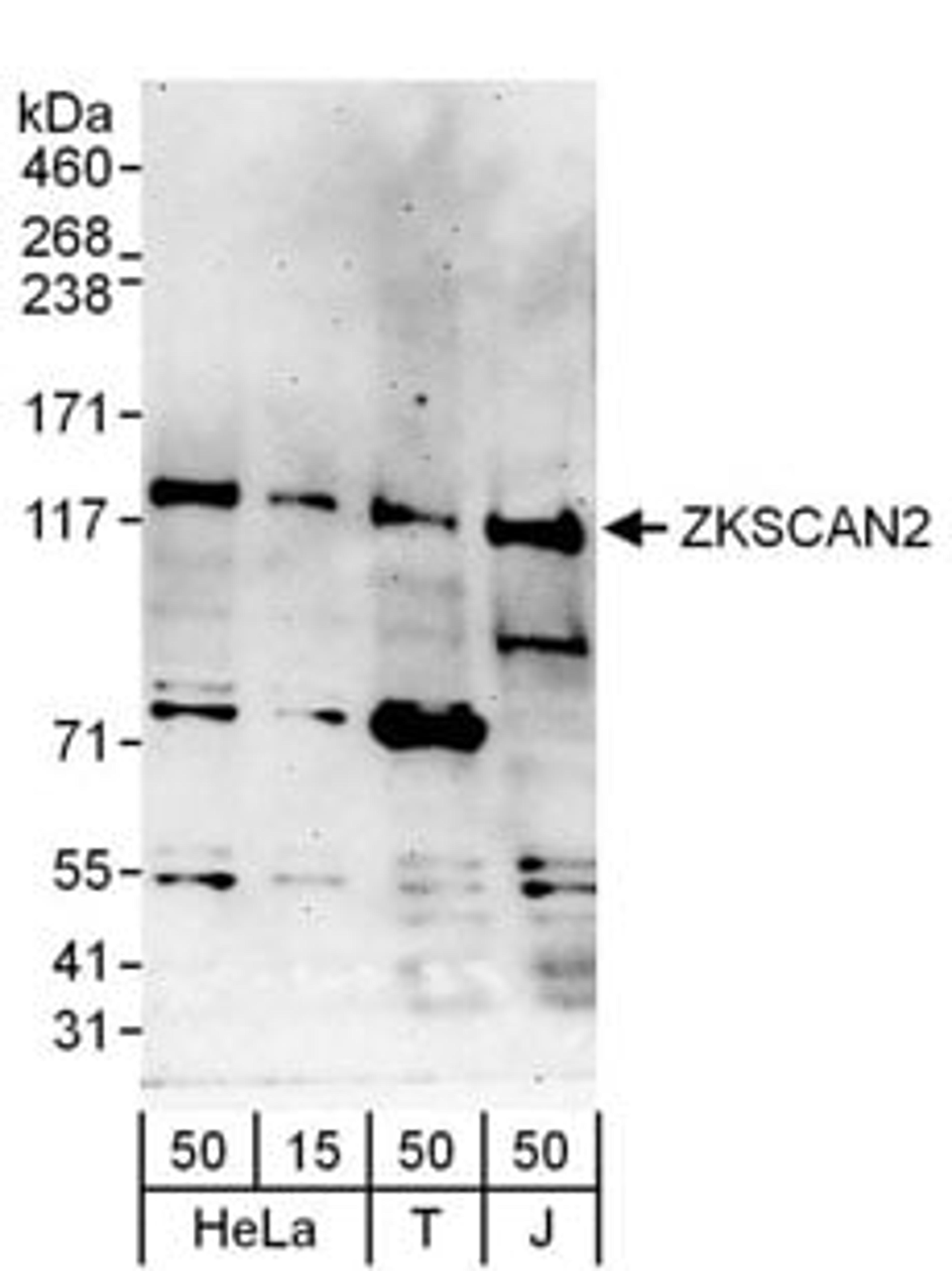 Detection of human ZKSCAN2 by western blot.