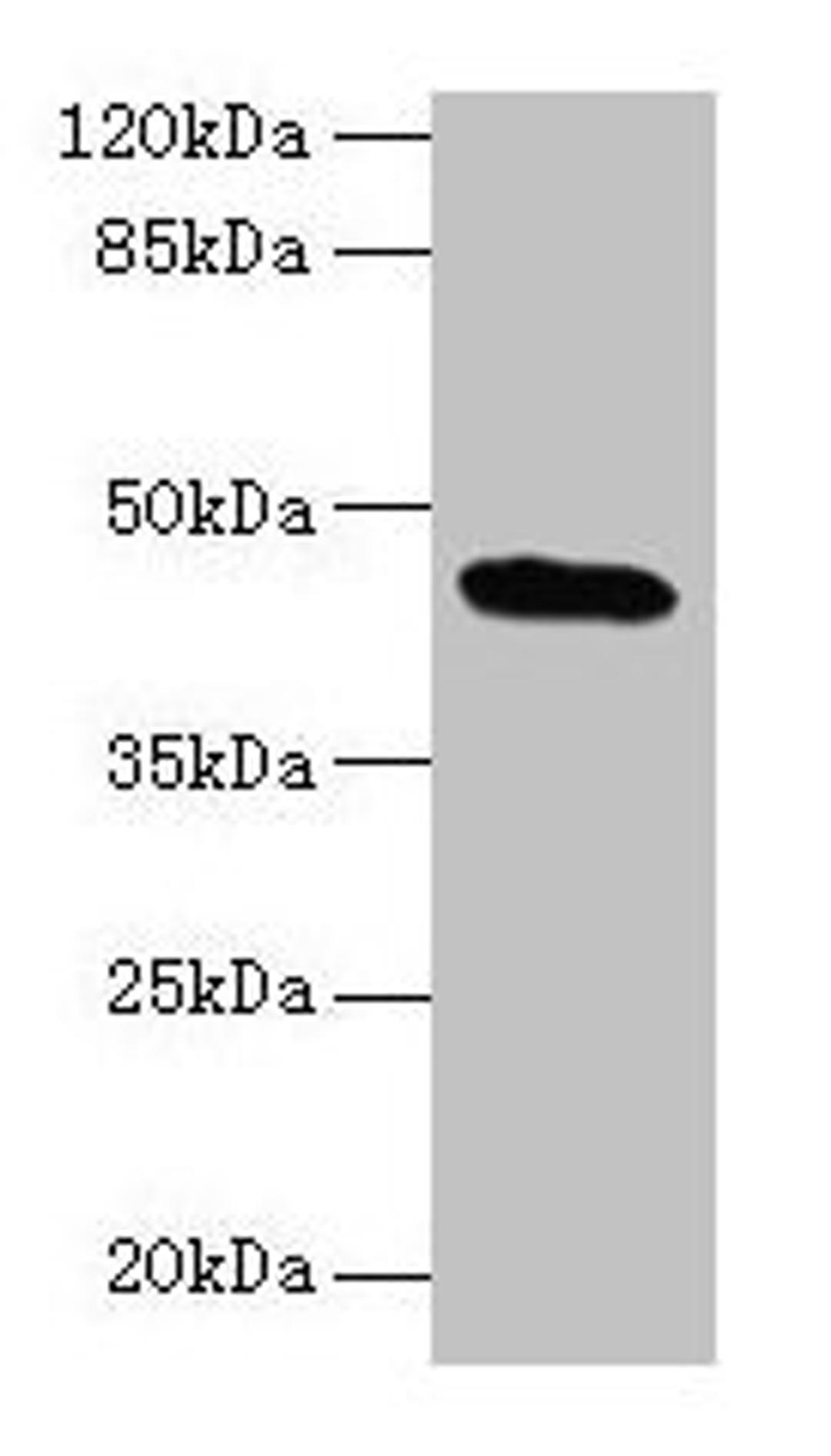 Western blot. All lanes: C19orf47 antibody at 10µg/ml + Mouse muscle tissue. Secondary. Goat polyclonal to rabbit IgG at 1/10000 dilution. Predicted band size: 45, 38, 30 kDa. Observed band size: 45 kDa