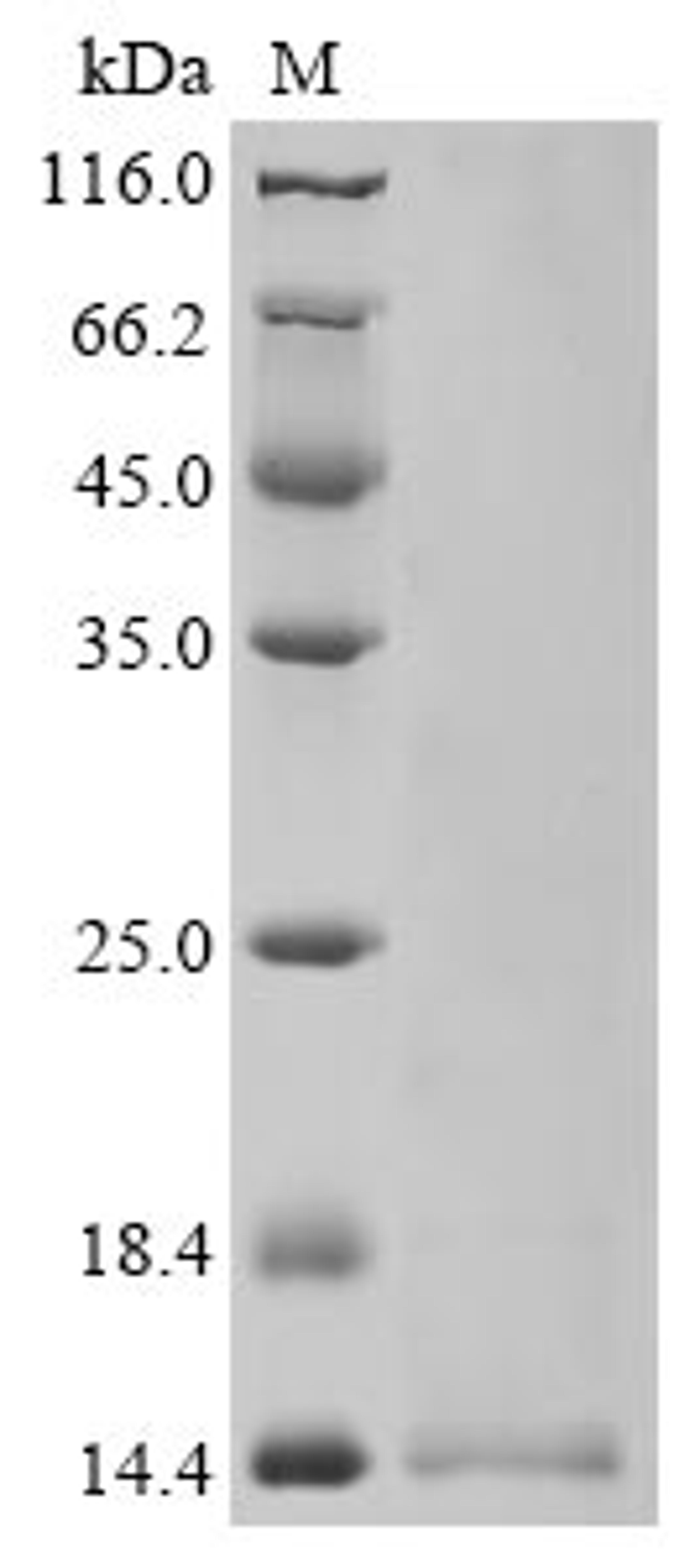 (Tris-Glycine gel) Discontinuous SDS-PAGE (reduced) with 5% enrichment gel and 15% separation gel.