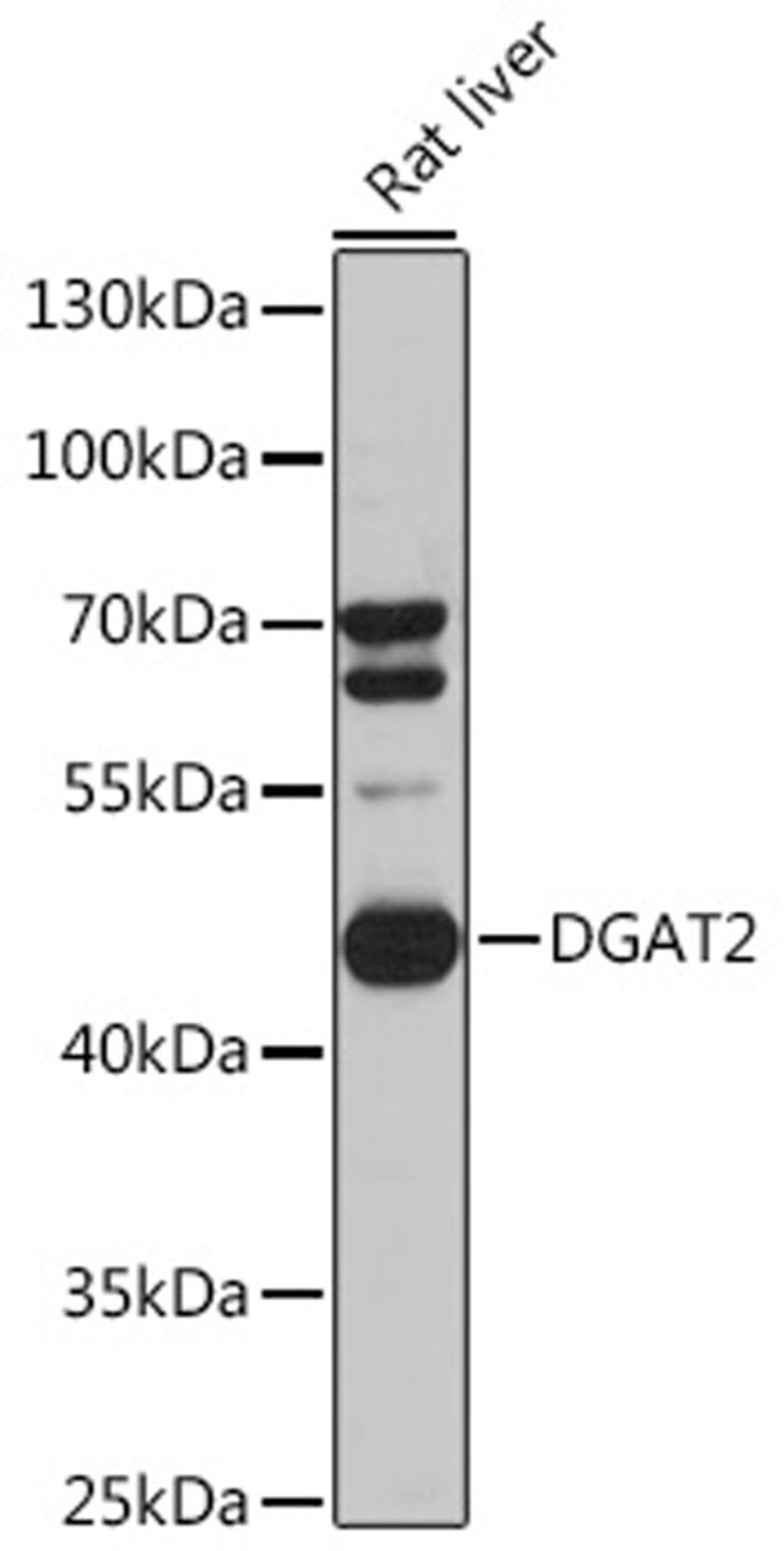 Western blot - DGAT2 antibody (A13891)