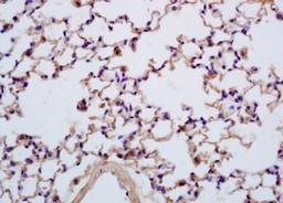 Immunohistochemical analysis of formalin-fixed paraffin embedded mouse lung tissue using SEZ6L antibody (dilution at 1:200)