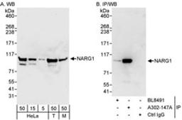 Detection of human and mouse NARG1 by western blot (h&m) and immunoprecipitation (h).