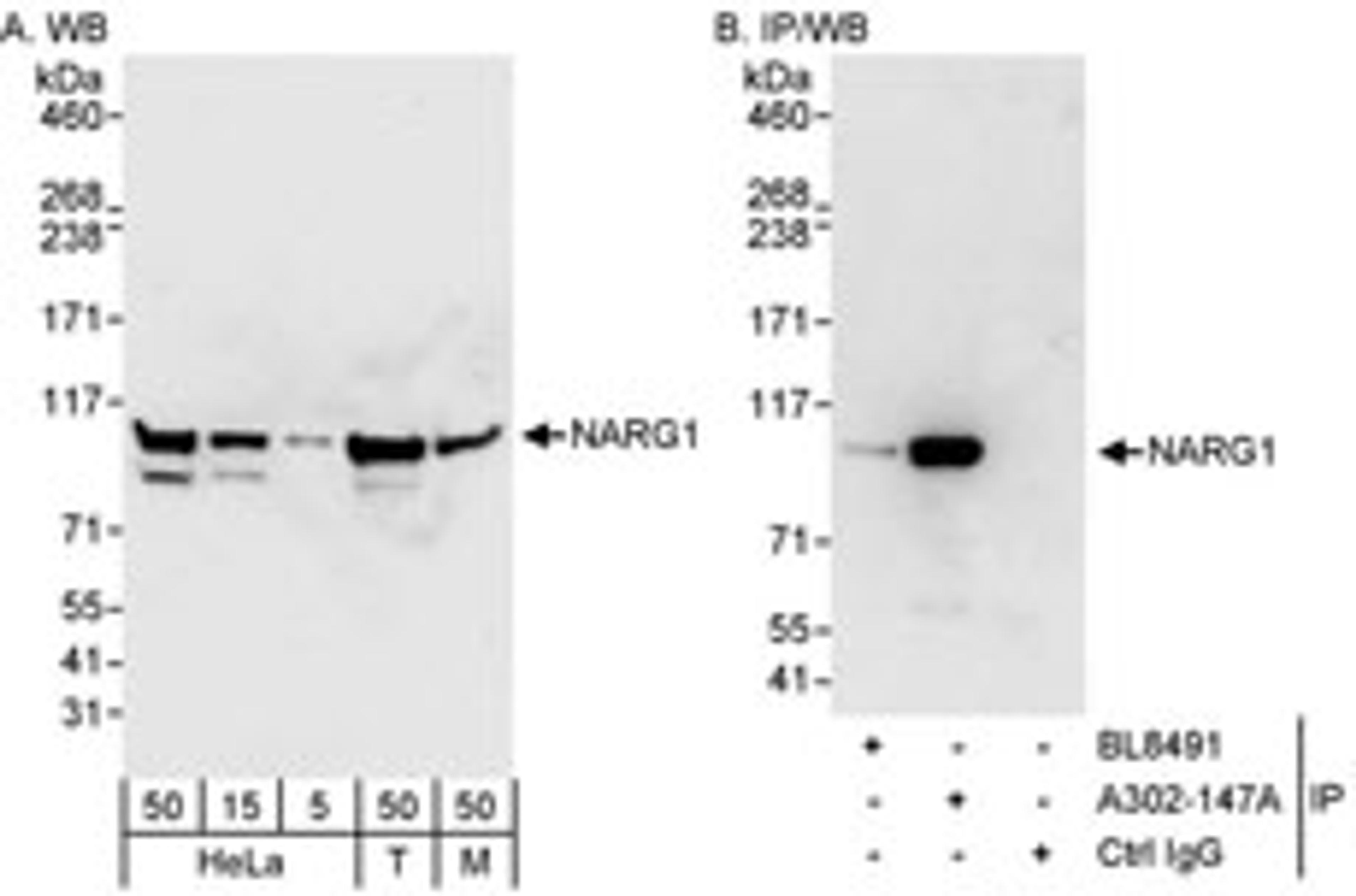 Detection of human and mouse NARG1 by western blot (h&m) and immunoprecipitation (h).