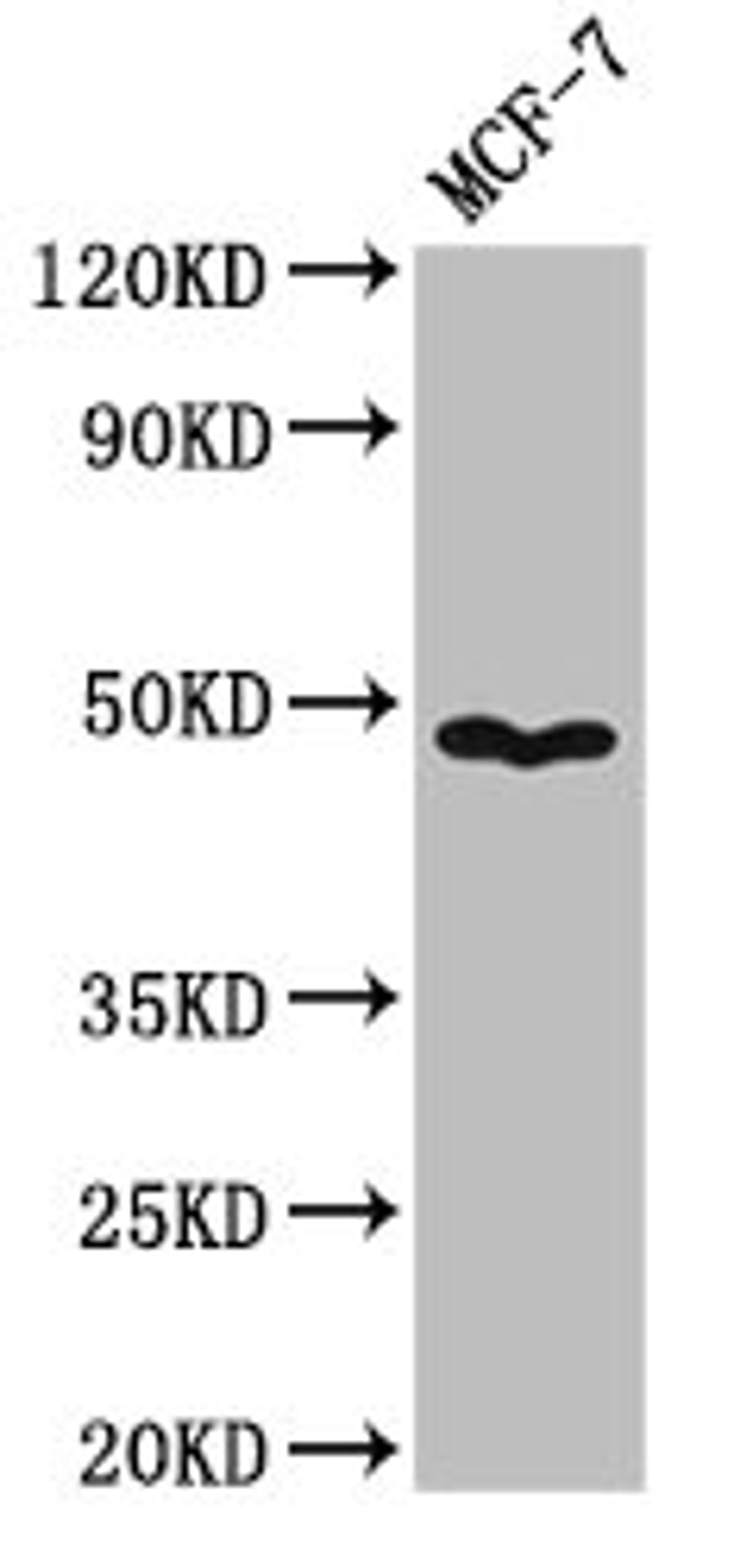 Western Blot. Positive WB detected in: MCF-7 whole cell lysate. All lanes: PANX1 antibody at 3.2µg/ml. Secondary. Goat polyclonal to rabbit IgG at 1/50000 dilution. Predicted band size: 49, 48 kDa. Observed band size: 49 kDa