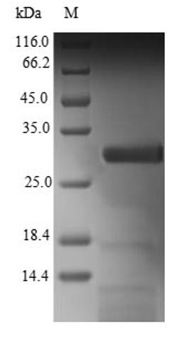 (Tris-Glycine gel) Discontinuous SDS-PAGE (reduced) with 5% enrichment gel and 15% separation gel.