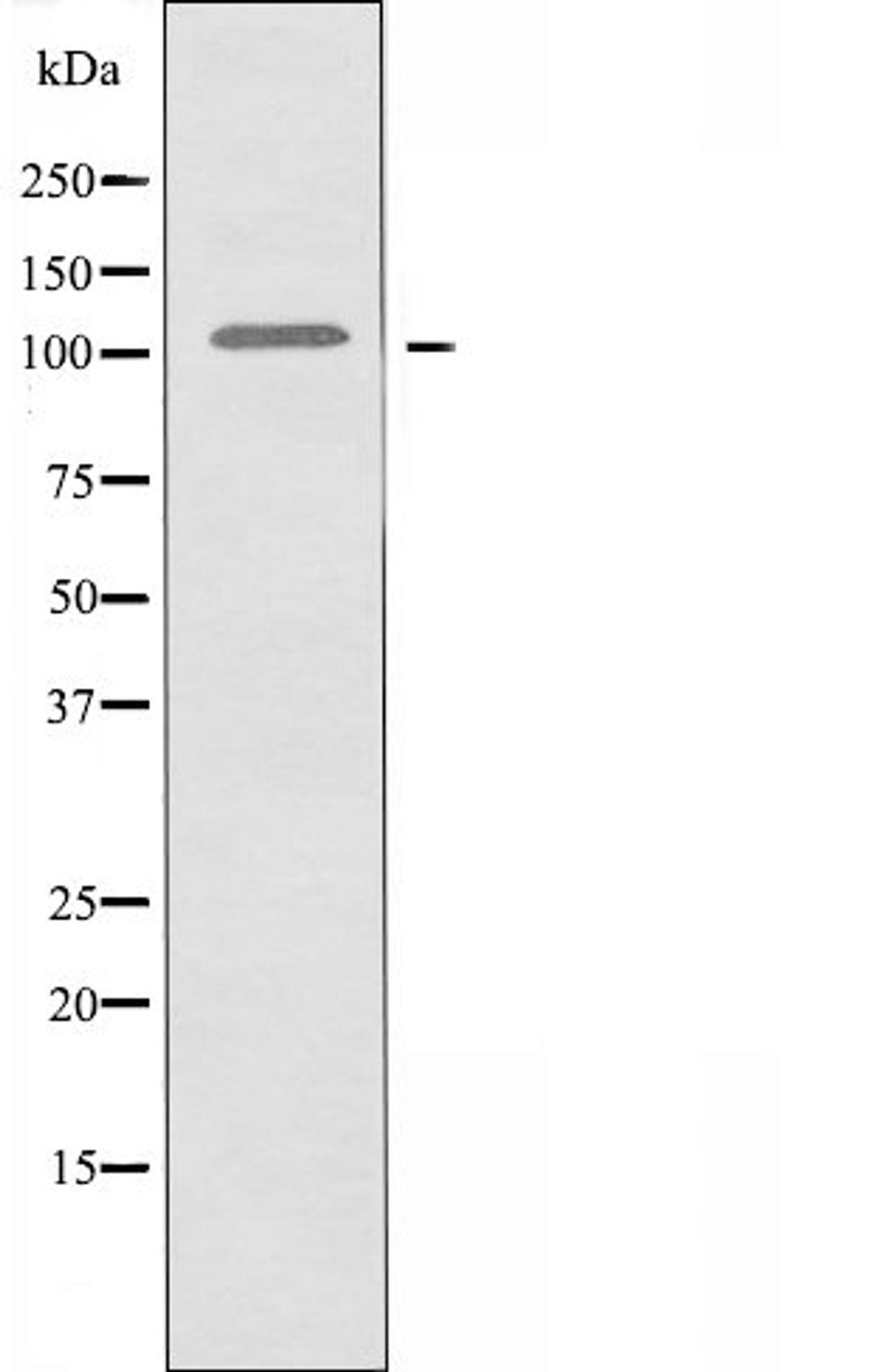 Western blot analysis of K562 cells HT-29 cells A549 cells and COS-7 cells using Collagen VI Alpha2 antibody