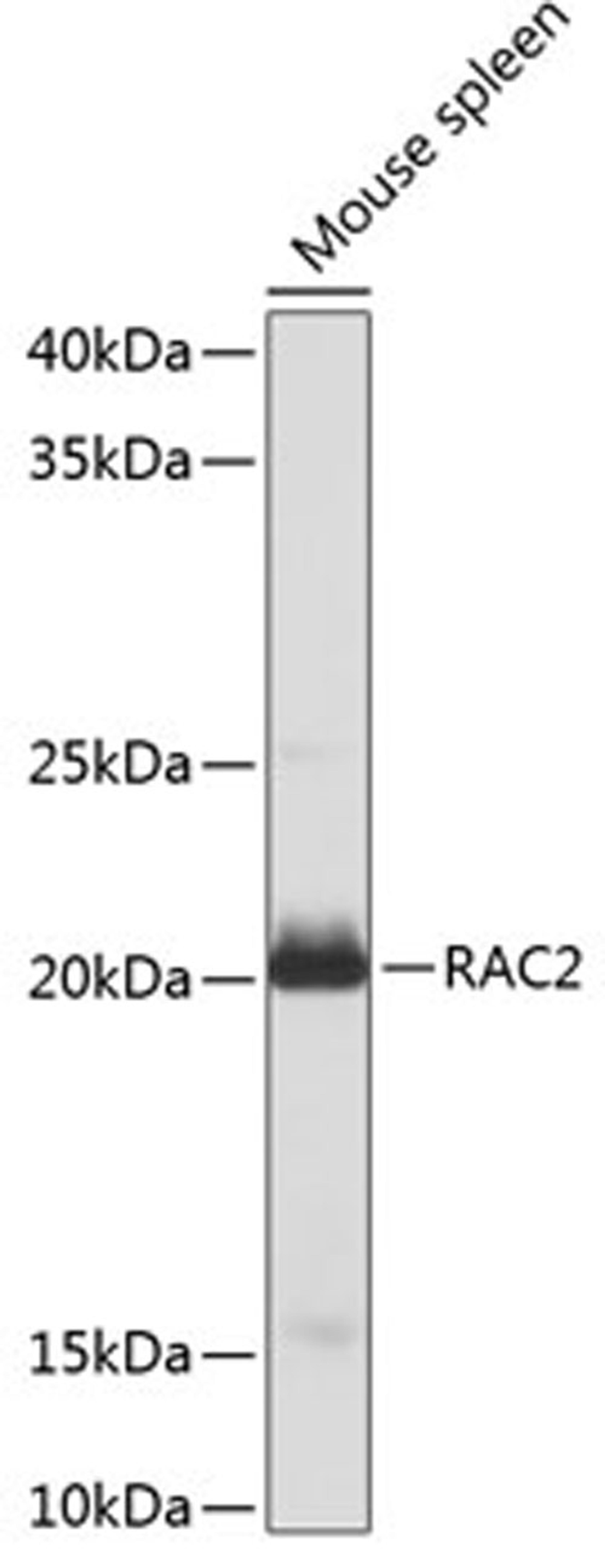 Western blot - RAC2 Polyclonal Antibody (A1139)