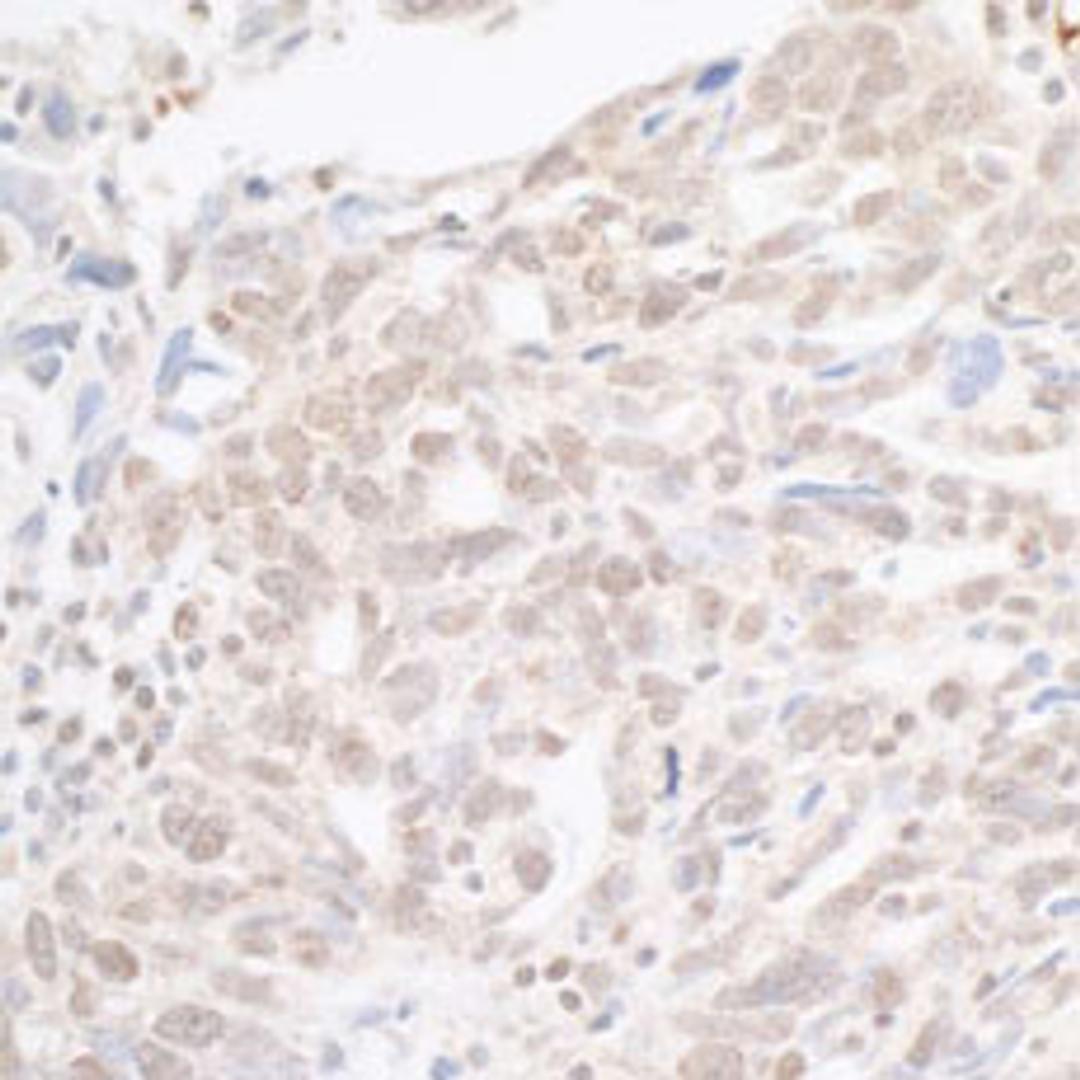 Detection of human hSET1 by immunohistochemistry.