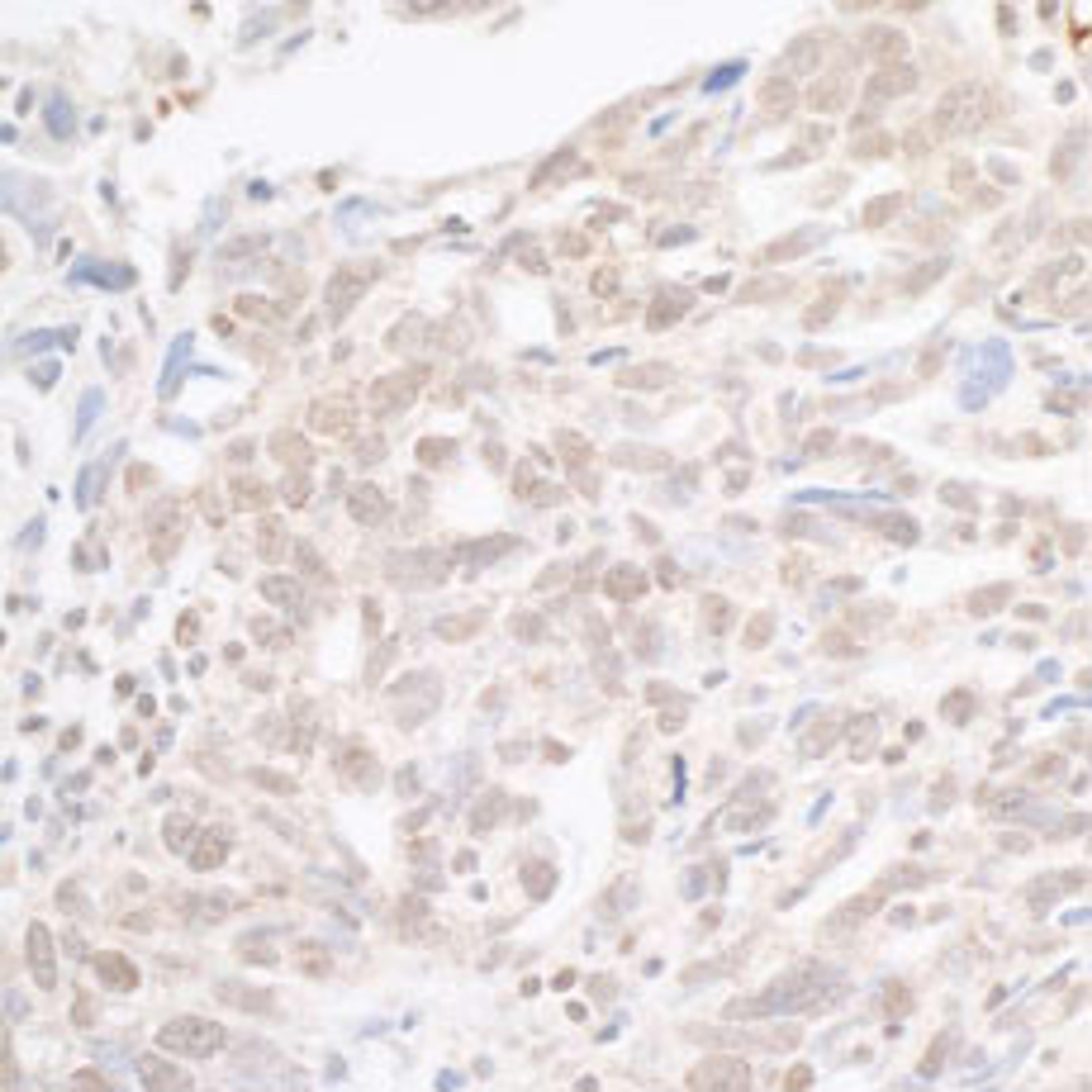 Detection of human hSET1 by immunohistochemistry.