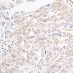 Detection of human hSET1 by immunohistochemistry.