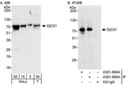 Detection of human DjC21 by western blot and immunoprecipitation.