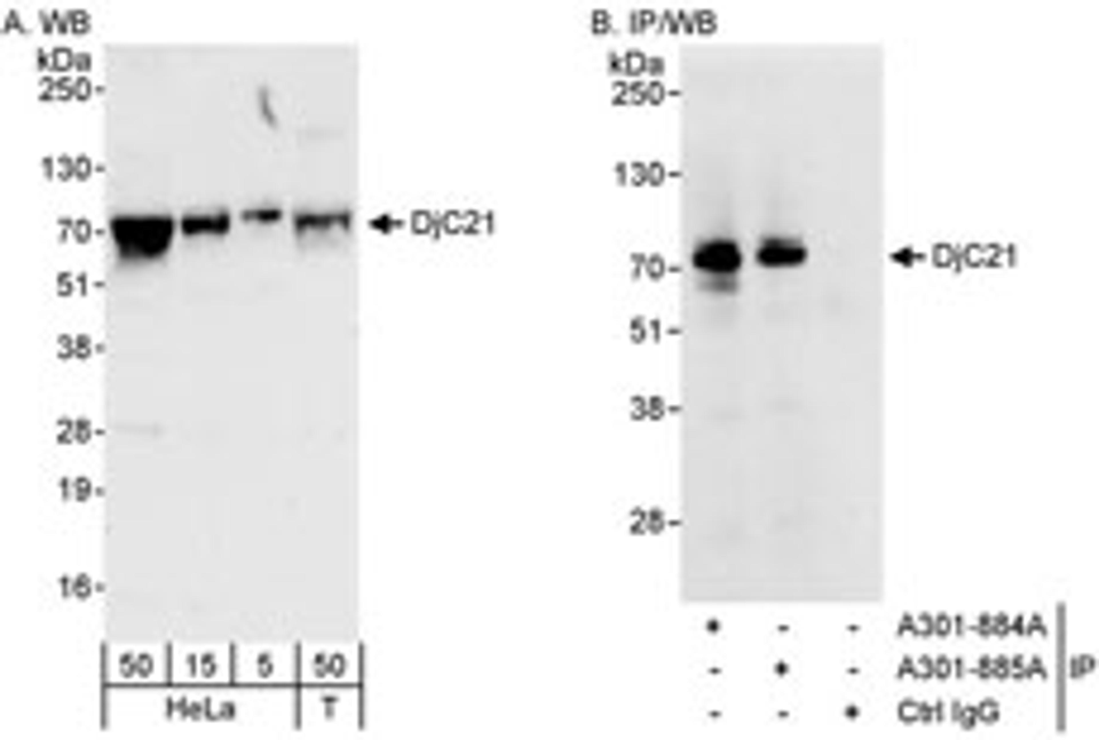 Detection of human DjC21 by western blot and immunoprecipitation.