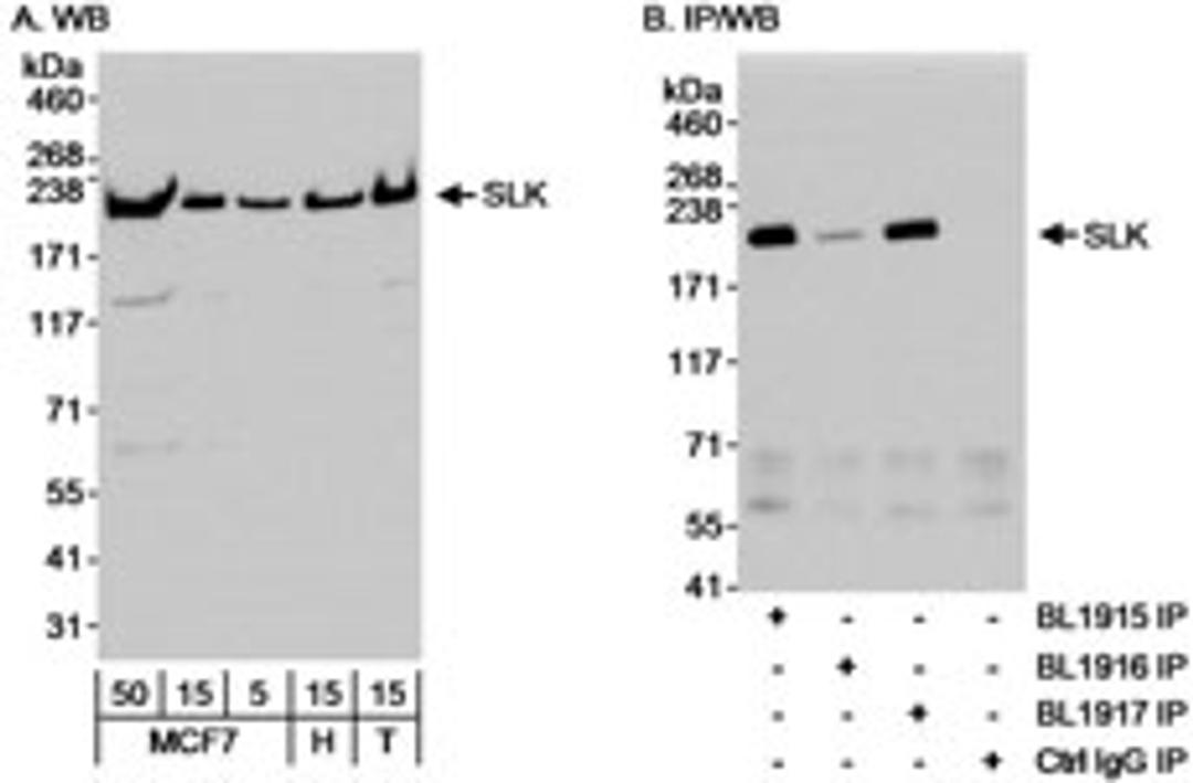 Detection of human SLK by western blot and immunoprecipitation.