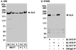 Detection of human SLK by western blot and immunoprecipitation.