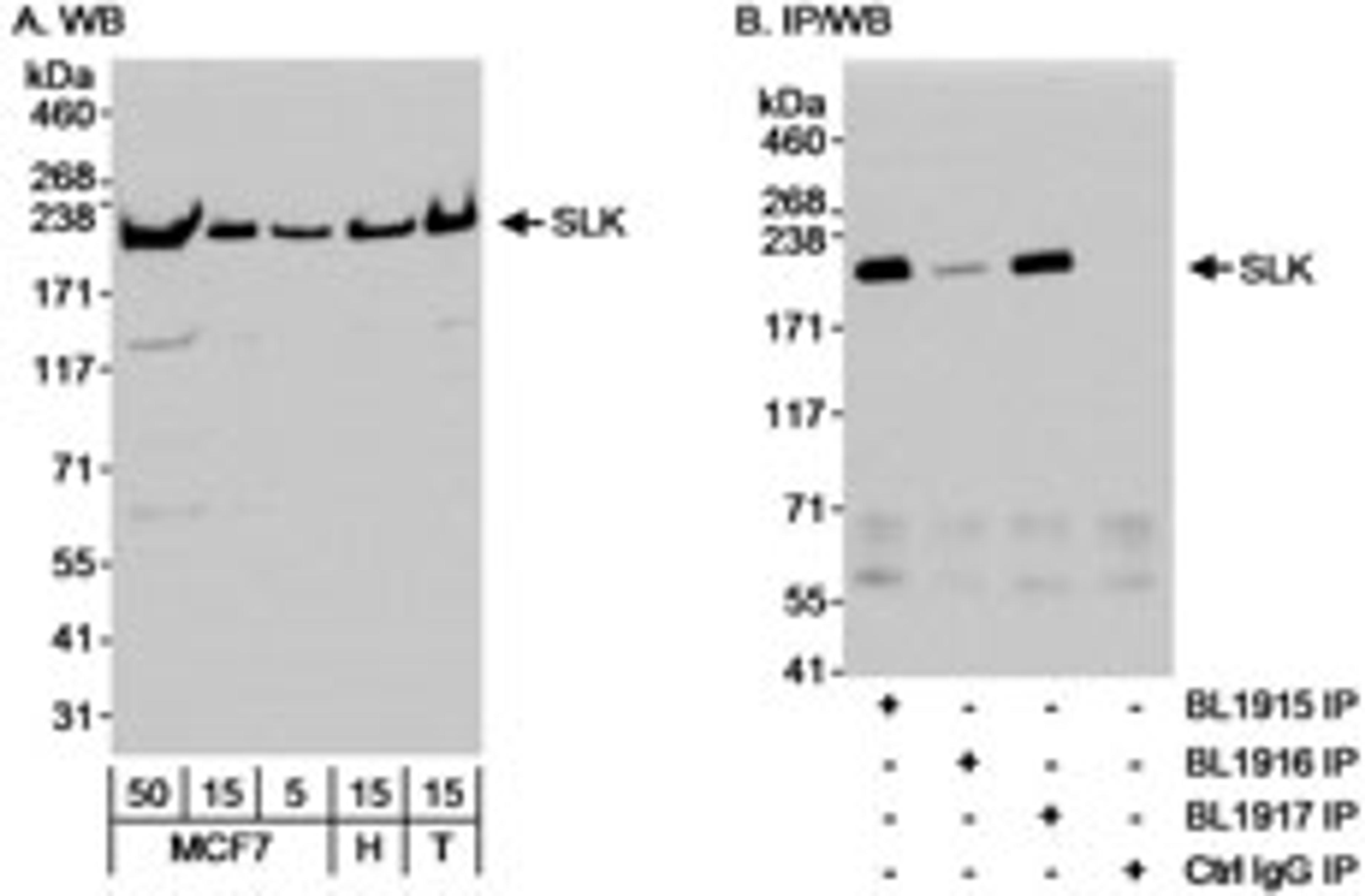 Detection of human SLK by western blot and immunoprecipitation.