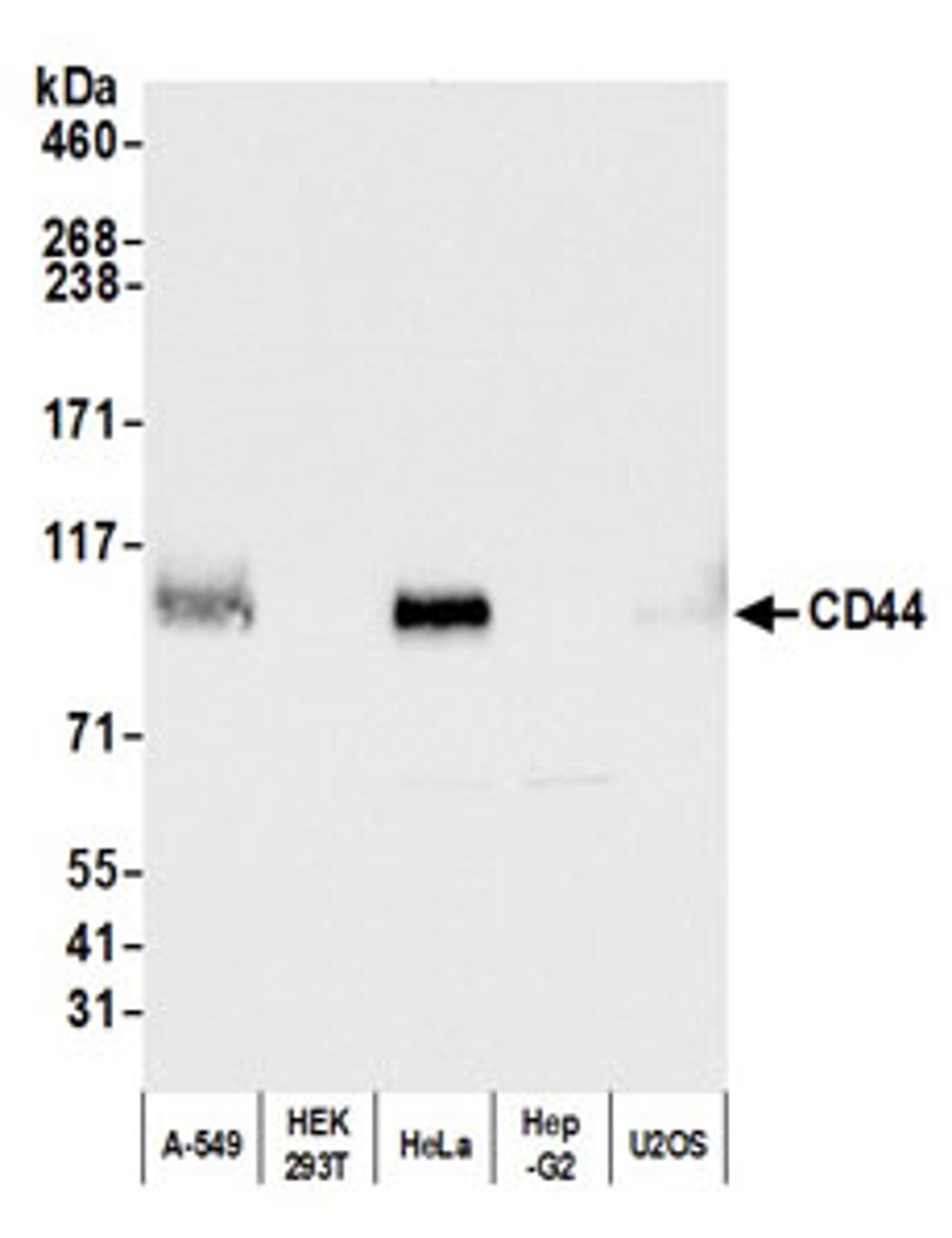 Detection of human CD44 by western blot.