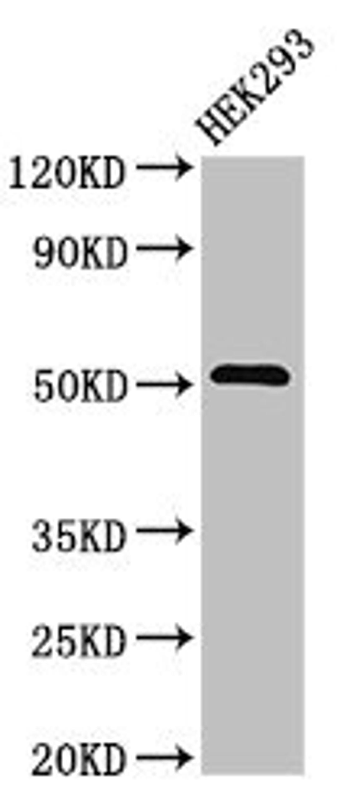 Western Blot. Positive WB detected in: HEK293 whole cell lysate. All lanes: TNFRSF10A antibody at 3.2ug/ml. Secondary. Goat polyclonal to rabbit IgG at 1/50000 dilution. Predicted band size: 51 kDa. Observed band size: 51 kDa.