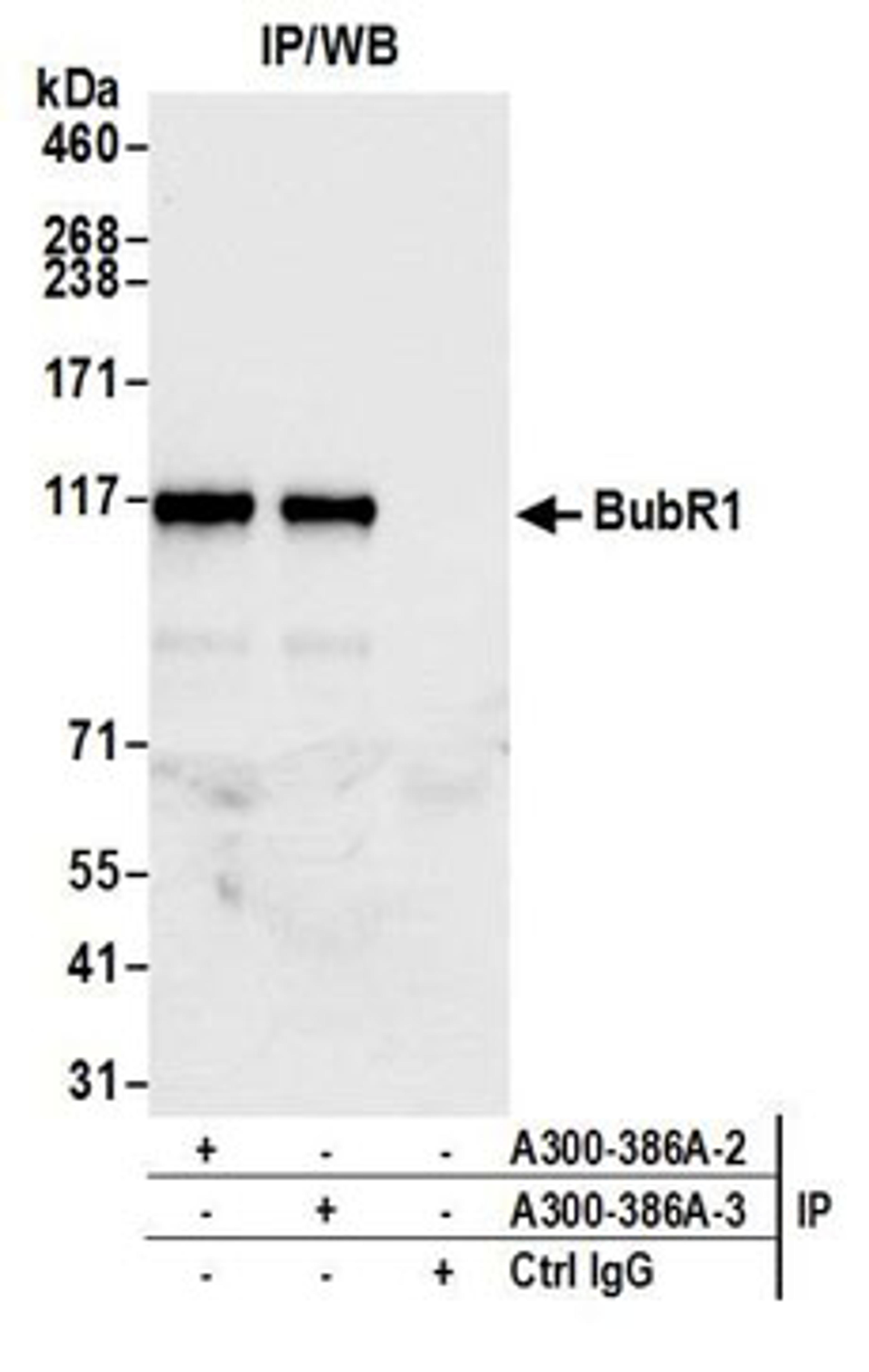 Detection of human BubR1 by western blot of immunoprecipitates.