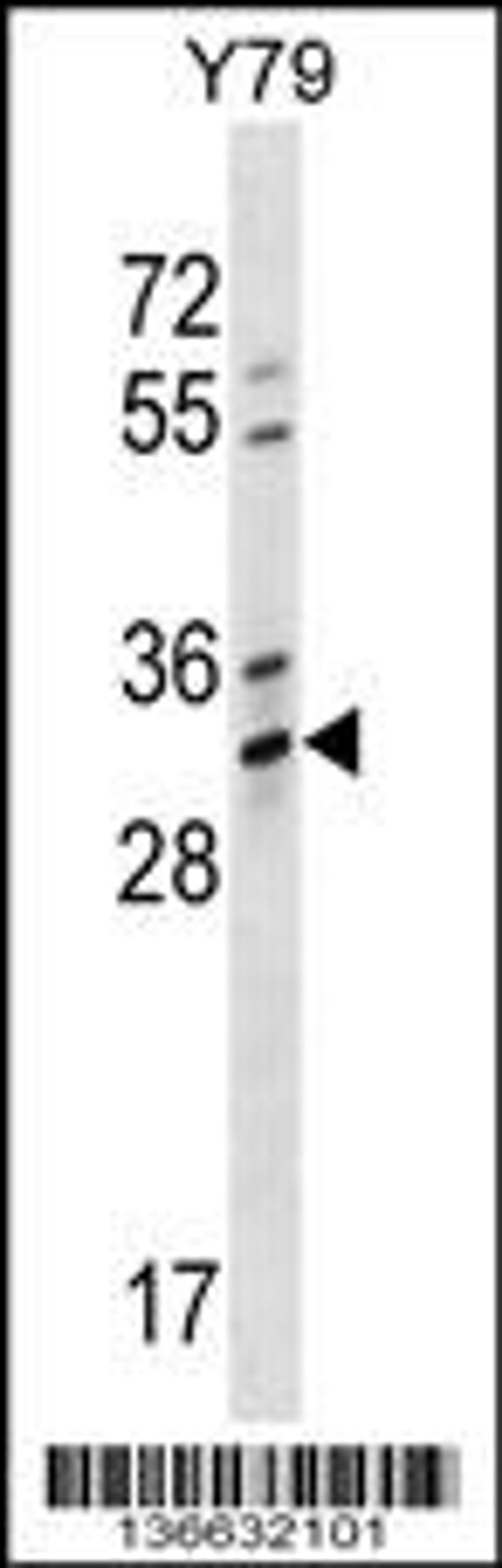 Western blot analysis in Y79 cell line lysates (35ug/lane).