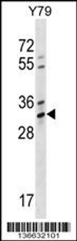 Western blot analysis in Y79 cell line lysates (35ug/lane).